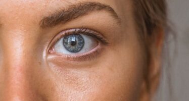 Comedones, Small Bumps, Oily Skin: A guide to teenage skin care