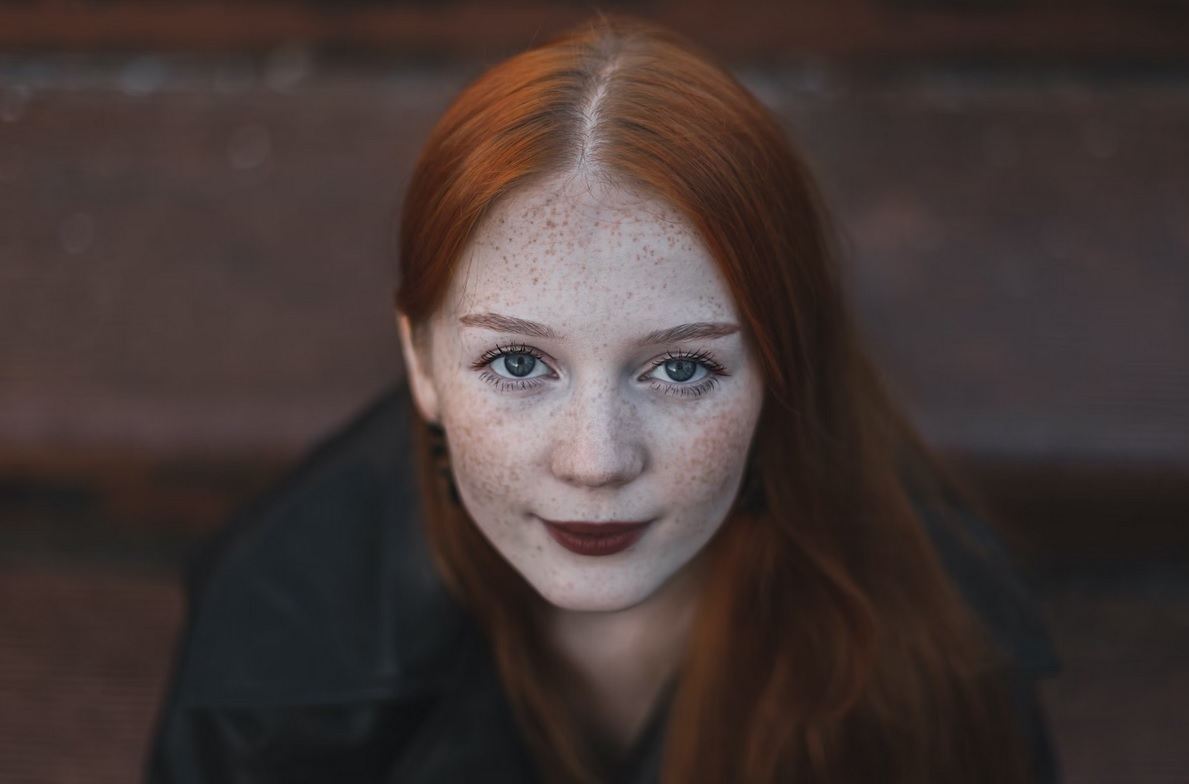 freckles unsplash